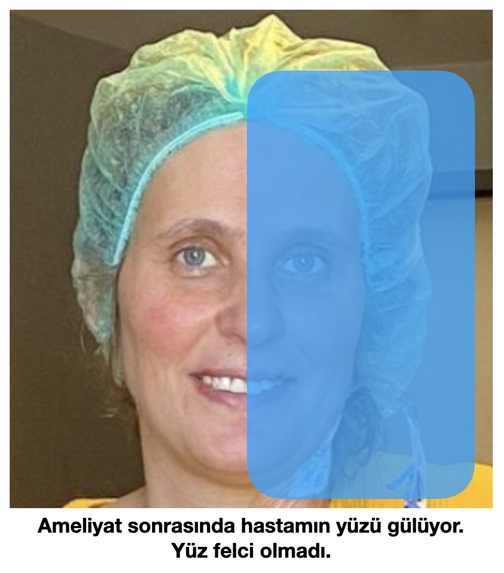 PCA_tumor_right_after_operation